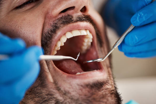 Best Emergency Denture Repair in Monette, AR