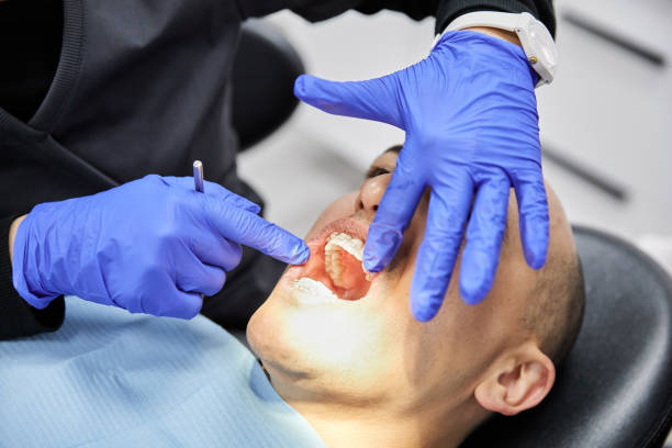 Best Emergency Dental Care for Broken or Chipped Teeth in Monette, AR